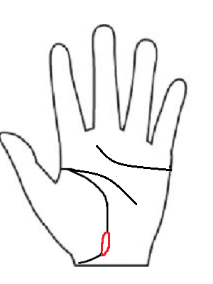 手相　生命線に大きな島楕円　画像　手相後藤